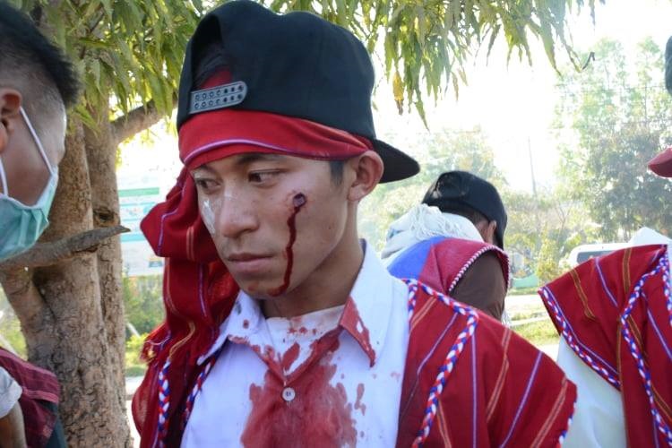 A Karenni youth demonstrator shot with rubber bullet by police (Photo: KTimes)
