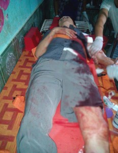 Photo caption: Wounded victim Saw Hla Min (Photo: MNA)